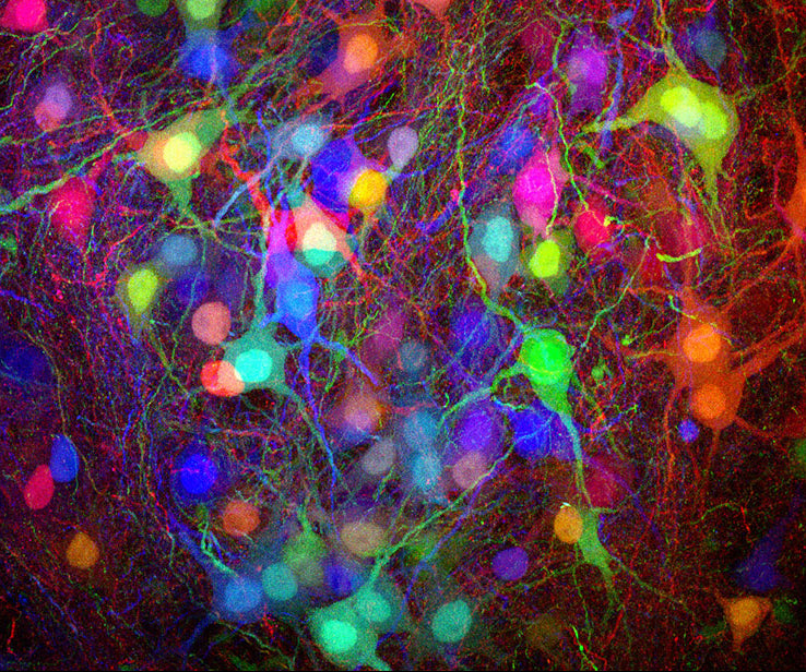 Neuronal network with colorful fluorescence under a microscope